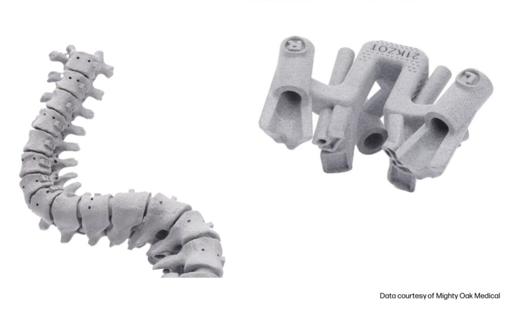 3D-Druck von Bohrschablonen für chirurgische Anwendungen